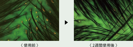 �|���t�B����������������̔玉�Â܂肪���Ȃ��Ȃ�����r�ʐ^