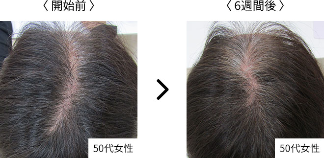連用でふんわりヘアスタイルに