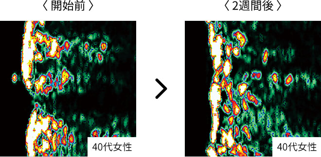 使用後はコラーゲン密度が高まり頭皮の弾力アップ
