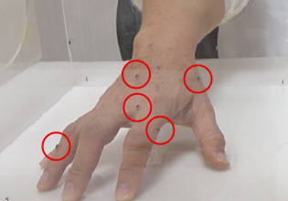 森の肌守り。UVミストを無塗布の手には虫がとまっています