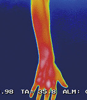 無塗布の腕のサーモグラフィー。赤色で表面温度の高さを示している