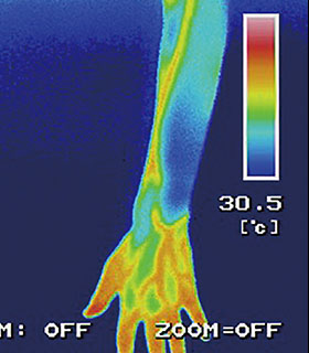 森の肌守り。UVを塗布した腕のサーモグラフィー。青色で表面温度の低さを示している