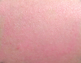 腕に塗布した『森の肌守り。UV』が残っている洗浄前の状態